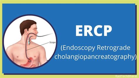 Endoscopic Retrograde Cholangiopancreatography ERCP YouTube