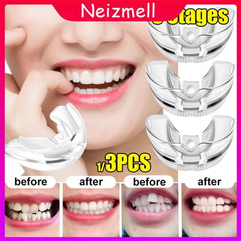 Neizmell 1 Set Phase 1 3 4d Invisible Teeth Orthodontic Aligner