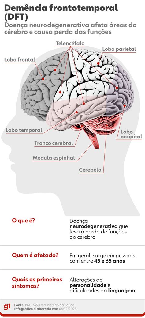 Demência Frontotemporal Entenda A Doença Que Afeta Bruce Willis