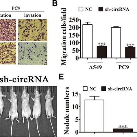 Hsa Circ Silencing Suppressed Tumor Growth Of Xenografts In