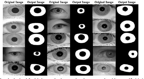 Figure 7 From Deep Learning Based Iris Segmentation Algorithm For