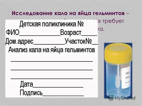 Анализ на энтеробиоз: важность процедуры, рекомендации по подготовке ...