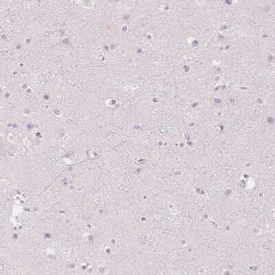 MMR CD206 Mannose Receptor Antibody NBP1 90020 By Novus Part Of Bio