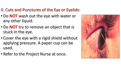 Eye injuries and first aid response | PPT