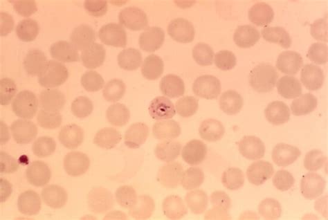 Free Picture Plasmodium Vivax Gametocyte Mature Trophozoite Parasite