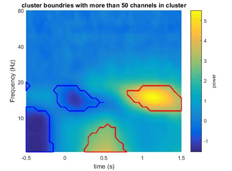 Time Frequency Analysis Oscillatory Power During Cueing In The