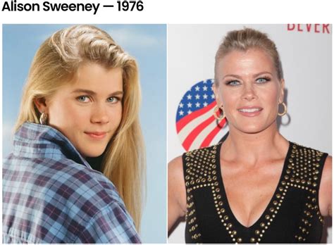 Alison Sweeney | Celebrities Before and After