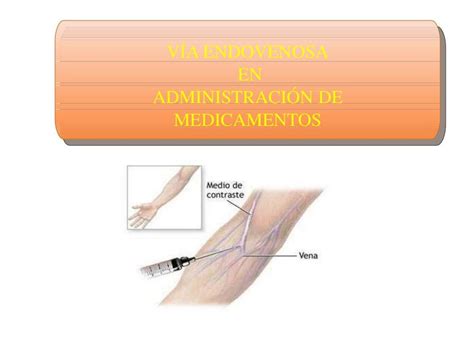 Vía Endovenosa En Administración De Medicamentos Francisco Ugarte Udocz