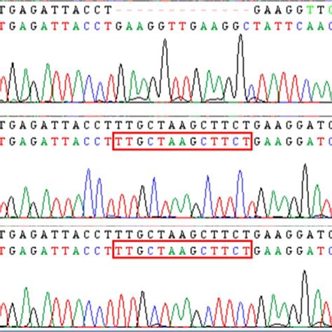 Sanger Sequencing Was Performed In The 8 Male Patients And Their