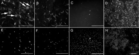 Immunofluorescent Staining Of Albumin Sections A And B Show Albumin