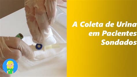 A Coleta De Urina Em Pacientes Sondados Youtube