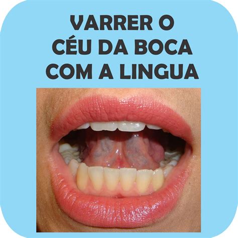 ADESIVOS TERAPÊUTICOS MOTRICIDADE ORAL 100 UNIDADES