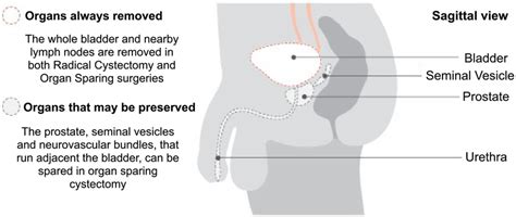 Diagram of male pelvic anatomy³ | Download Scientific Diagram