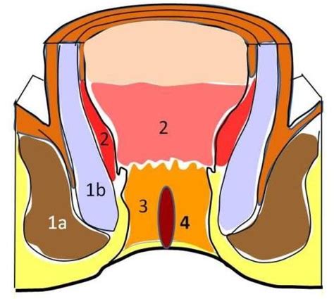 Ardor No Nus Fissura Anal Dr Michael W Groh