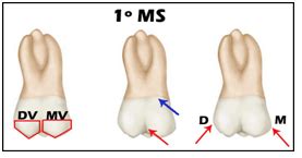 Anatomia Do Primeiro Molar Superior Resumo De Anatomia Dental