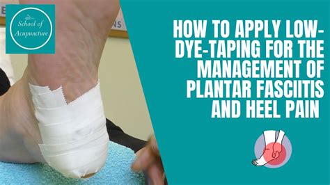 How To Apply Low Dye Taping For The Management Of Plantar Fasciitis And