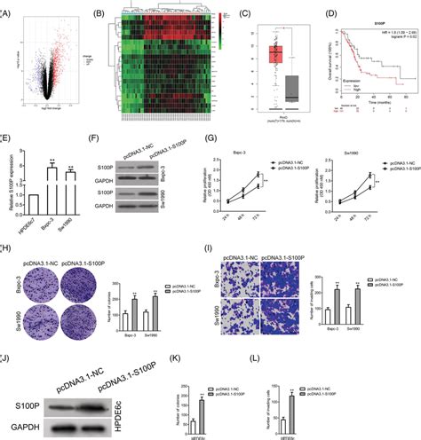 S P Is Upregulated In Pancreatic Cancer A Identification Of