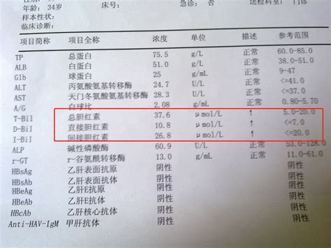 总胆红素偏高说明什么（体检查出胆红素高是什么原因？3个危害，早发现早治疗） 说明书网