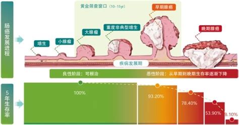 结直肠癌无创筛查技术：粪便sdc2甲基化检测 武汉市江夏区第一人民医院