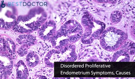 Disordered Proliferative Endometrium Causes And Symptoms