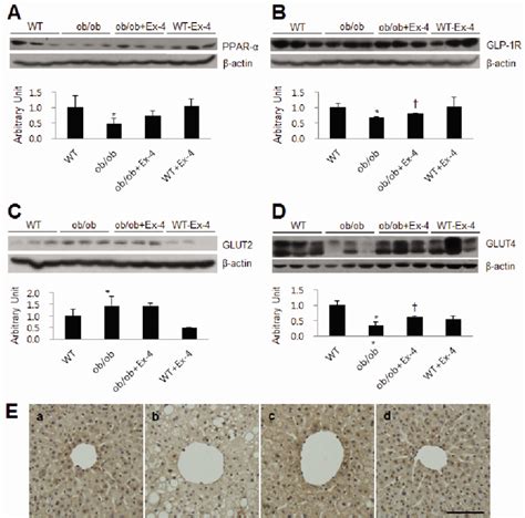 Effect Of Ex On Ppar Glp R Glut And Glut Expression In The