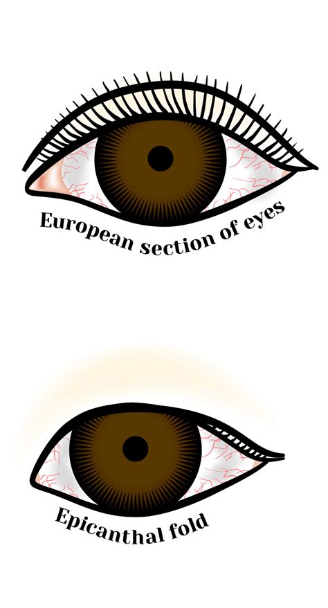 Monolid Eyes and Epicanthal Folds | Eastern Plastic Surgery