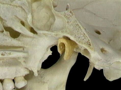 Bony Structures Around The Nasopharynx Aclands Video Atlas Of Human