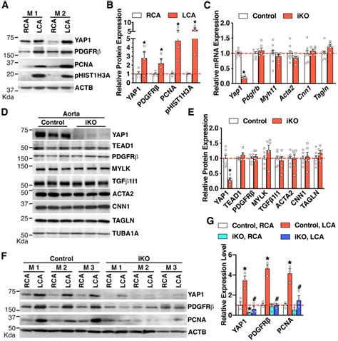 Yap Tead Upregulate Platelet Derived Growth Factor Receptor Beta To