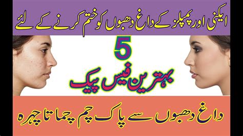 Pimples Ke Nishan Khatam Karne Ka Tarika How To Remove Acne Marks By