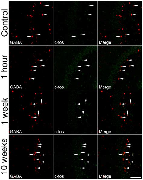 Representative Images Show C Fos Expression In GABA Immunoreactive