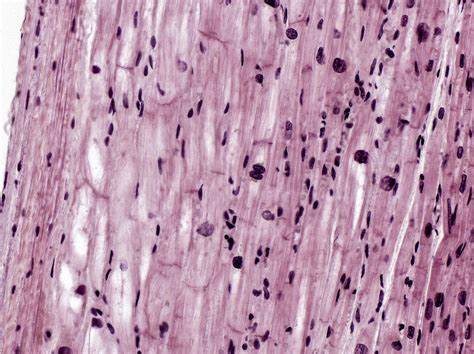 Purkinje Fibers Histology