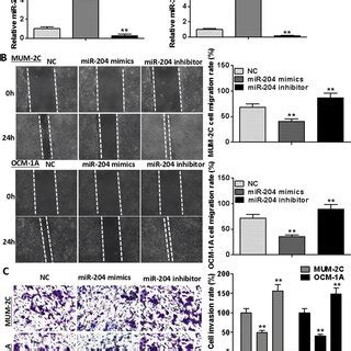 MiR 204 Suppresses UM Cell Invasion And Migration A MiR 204 Expression