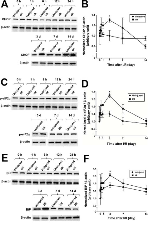 Figure 1 From Role Of C Ebp Homologous Protein In Retinal Ganglion Cell