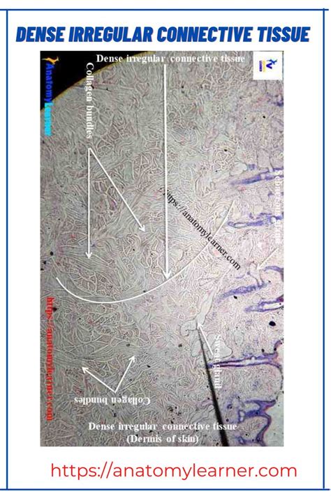 Dense irregular connective tissue histology | Tissue, Irregular ...