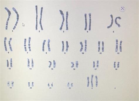 Solved Identify The Biological Sex And The Chromosome Chegg