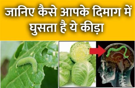 By Eating Cabbage This Worm Reaches The Brain पत्ता गोभी खाने से