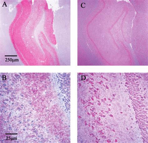 Immunohistochemical staining of rat brain. Staining of rat hippocampal ... 
