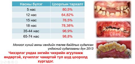 Монголчууд жилд 522 тэрбум төгрөгөөр өвчин” худалдан авч байна