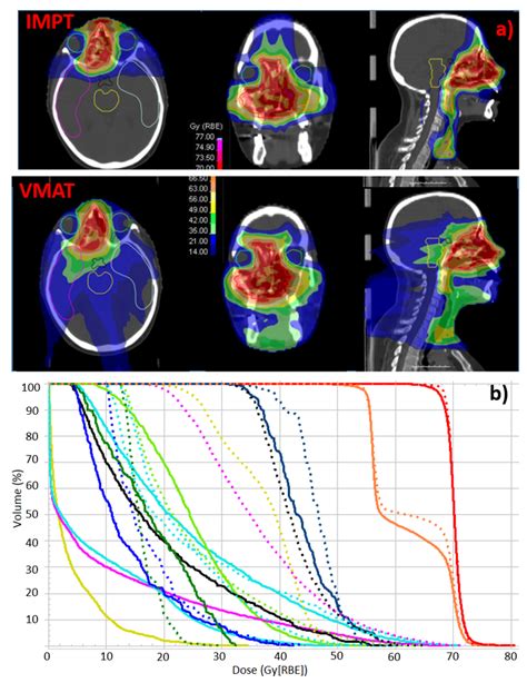 A Representative Example Of Dose Distribution For Impt And Vmat