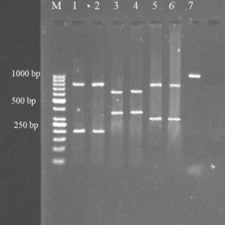 Representative RFLP Analysis Patterns Of The Amplified ITS1 RDNA Region