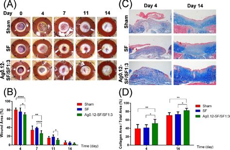 Representative Macroscopic Images And Masson Staining Images Of Wounds