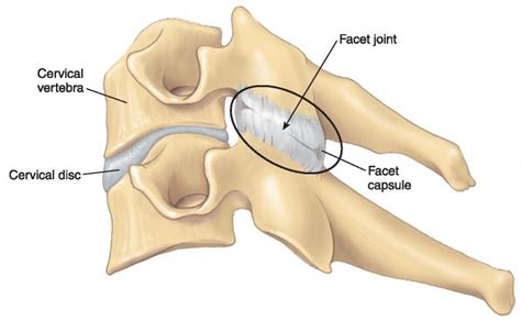 Cervical Cyst