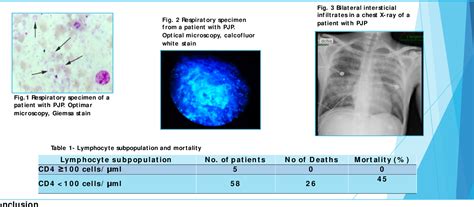 Figure 2 From Aids Related Pneumocystis Jirovecci Pneumonia In An Intensive Care Unit A