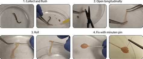 Workflow Of The Improved Swiss Rolling Technique For Intestinal Tissue Download Scientific