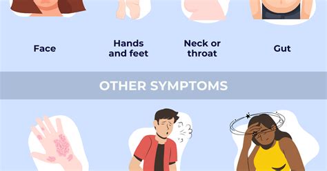 Symptoms of angioedema | Angioedema News