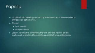 Papilledema vs papillitis with notes timothy zagada | PPT