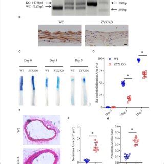 Zyxin Deficiency Delays Re Endothelialization And Promotes Neointima