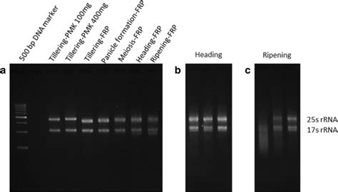 Agarose Gel Electrophoresis Of Rna A Rna Extracted By Different Download Scientific Diagram