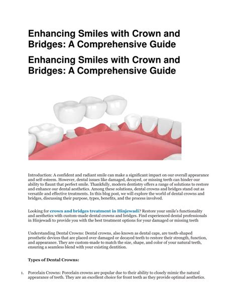 PPT Enhancing Smiles With Crown And Bridges PowerPoint Presentation