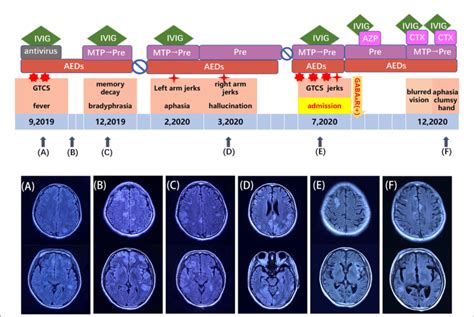 Figure Schema For The Disease Course Treatments And Mri Download Scientific Diagram